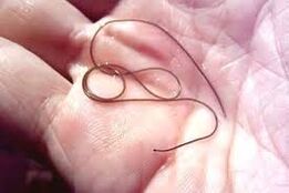 Parasite dans la paume de votre main