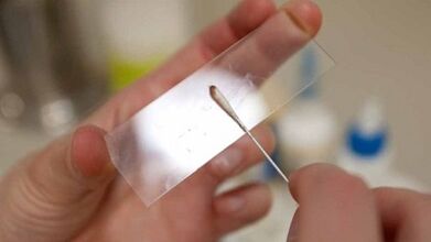 Analyse Calais pour identifier les parasites