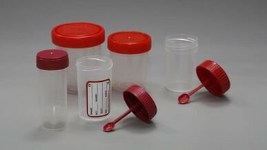 Comment se préparer au test des parasites