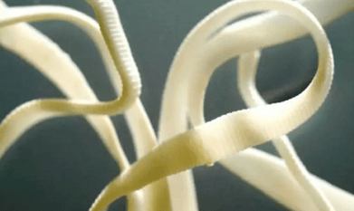 Comment éliminer les parasites du corps humain